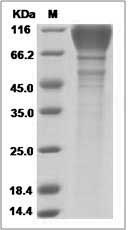 HIV-1 (group M, subtype B, strain SHIV-89.6P) gp120 Protein (His Tag)