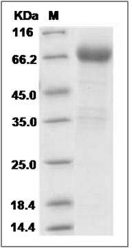 Rat IL-21R / Il21R Protein (Fc Tag)