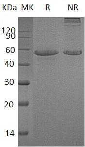 Human CLGN (His tag) recombinant protein