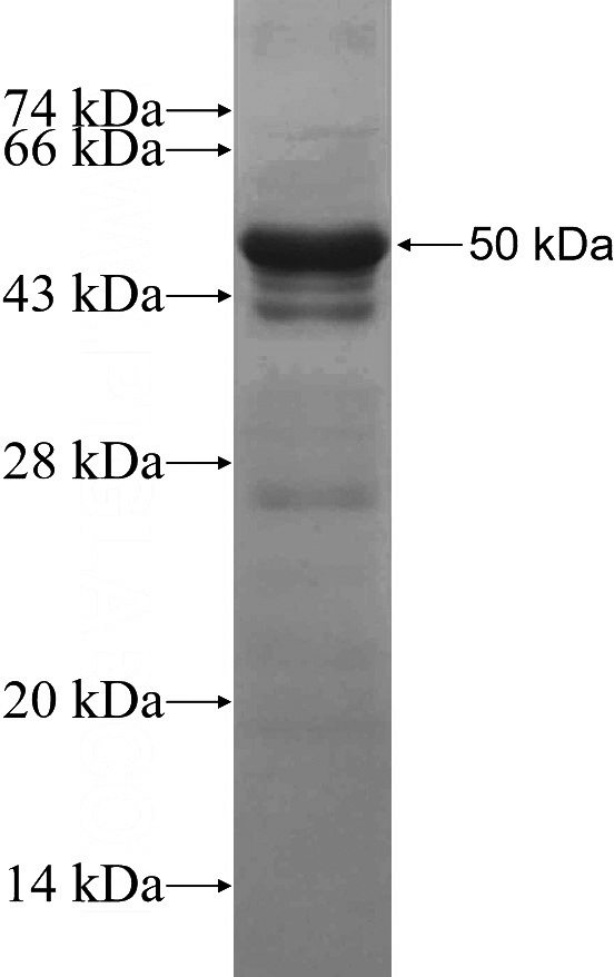 Recombinant Human IRF9 SDS-PAGE