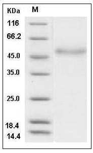 Human Coagulation Factor VII / FVII / F7 Protein (His Tag) SDS-PAGE