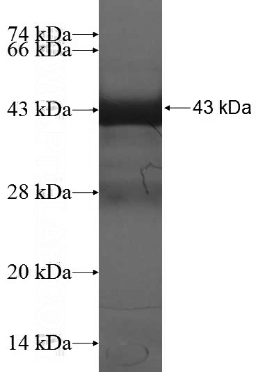 Recombinant Human HOXD10 SDS-PAGE