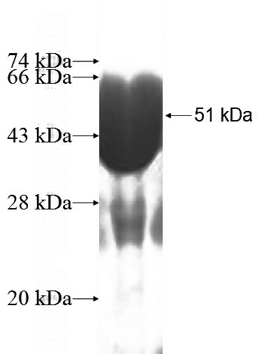 Recombinant Human PCMT1 SDS-PAGE