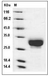 Human CD32a / FCGR2A Protein (167 His, His Tag) SDS-PAGE