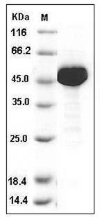 Human ALDH1 / ALDH1A1 / ALDC Protein (His Tag) SDS-PAGE