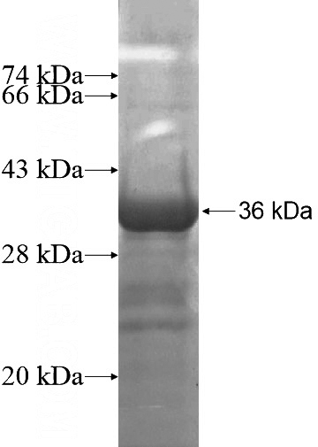 Recombinant Human AKR1CL2 SDS-PAGE