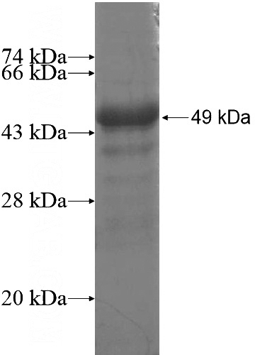 Recombinant Human RNF133 SDS-PAGE