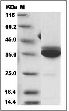 Human Statherin / STATH Protein (Fc Tag) SDS-PAGE