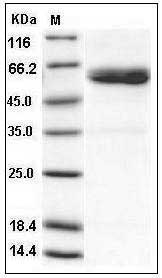 Human ULBP1 / RAET1 / N2DL1 Protein (His & Fc Tag) SDS-PAGE
