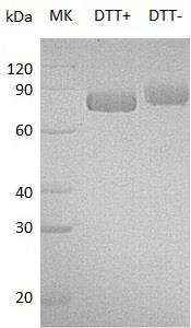 Human KLKB1/KLK3 (His tag) recombinant protein