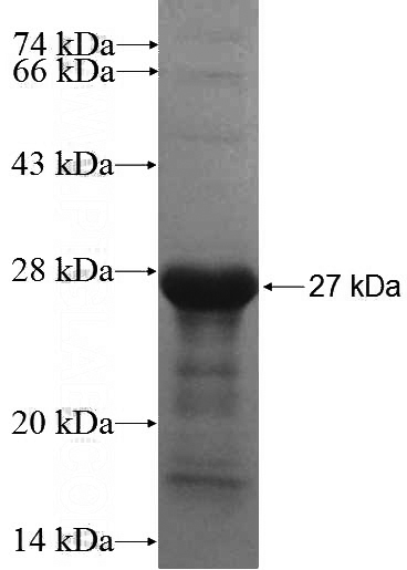 Recombinant Human ADCY3 SDS-PAGE