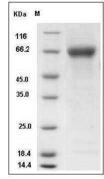 Influenza A H4N4 (A/mallard duck/Alberta/299/1977) Hemagglutinin / HA Protein (His Tag) SDS-PAGE