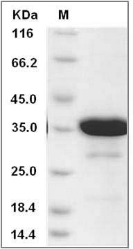 Human SAA4 Protein (GST Tag) SDS-PAGE