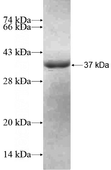 Recombinant Human ZWINT SDS-PAGE