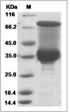 Plasmodium falciparum (strain 3D7) LDH / L-lactate dehydrogenase Protein (His Tag)