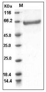 Human Coagulation Factor XIII B chain / F13B Protein (His Tag) SDS-PAGE