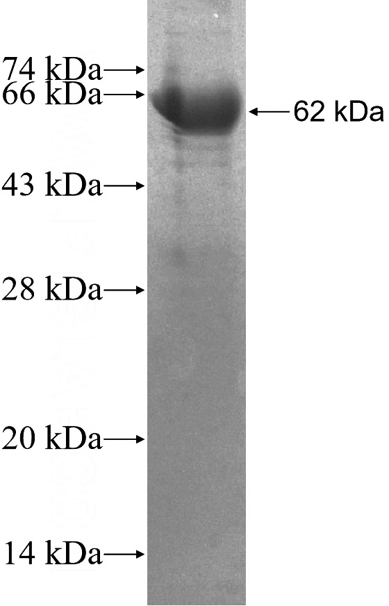 Recombinant Human ADD2 SDS-PAGE