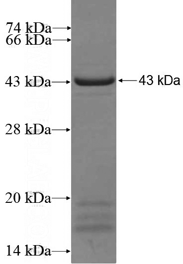 Recombinant Human CCPG1 SDS-PAGE