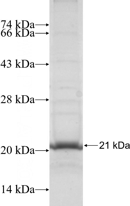 Recombinant Human RPL22 SDS-PAGE