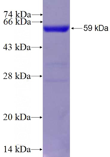 Recombinant Human ACTN2 SDS-PAGE