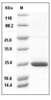 Human RAC2 Protein (His Tag) SDS-PAGE
