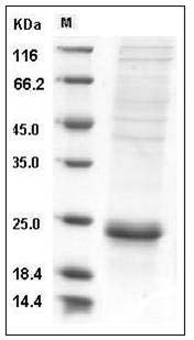 Human IL-17F / Interleukin-17F Protein (His Tag) SDS-PAGE