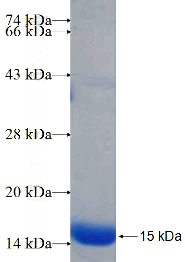 Recombinant Human CCDC114 SDS-PAGE