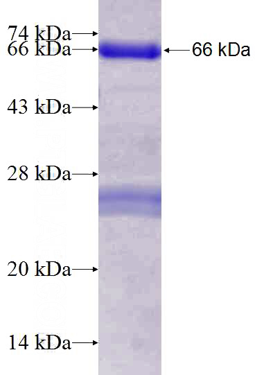 Recombinant Human HNRNPL SDS-PAGE