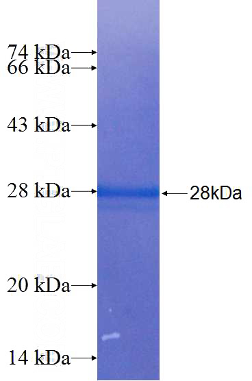 Recombinant Human TBK1 SDS-PAGE