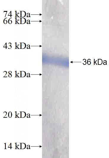Recombinant Human OBFC2B SDS-PAGE