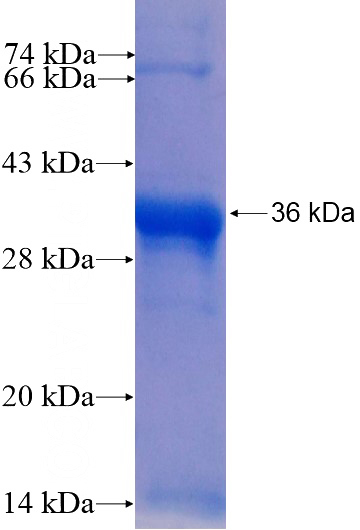 Recombinant Human ST3GAL6 SDS-PAGE