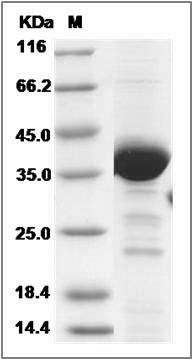 Human NAPG / Gamma SNAP Protein (His Tag) SDS-PAGE
