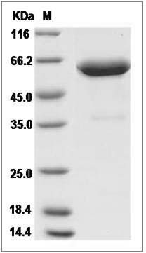 Mouse ANGPTL2 / Angiopoietin-like 2 Protein (Fc Tag) SDS-PAGE