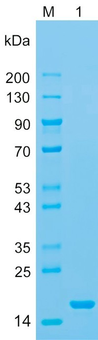 Recombinant IL1F10/IL-38 protein (His tag) SDS-PAGE