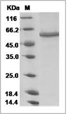 Influenza A H10N8 (A/duck/Guangdong/E1/2012) Neuraminidase / NA Protein (His Tag)