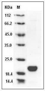 Human LCN1 / VEGP / Lipocalin-1 Protein (His Tag) SDS-PAGE