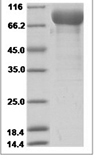 Human VEGFR2 / Flk-1 / CD309 / KDR Protein (Domain 1&2&3, Fc Tag)