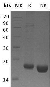 Human REG1A/PSPS/PSPS1/REG (His tag) recombinant protein