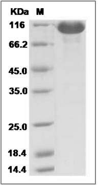 Rat EphA3 Protein (Fc Tag) SDS-PAGE