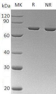 Human ANXA6/ANX6 (His tag) recombinant protein