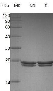 E.coli rppH/nudH/ygdP/b2830/JW2798 recombinant protein