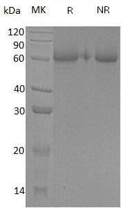 Human CDSN (His tag) recombinant protein