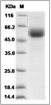 Rat TGFBR2 Protein (Fc Tag) SDS-PAGE