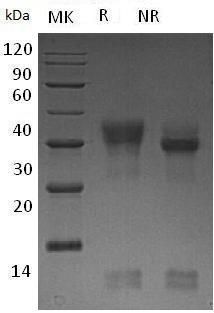 Human PIK3IP1/HGFL (His tag) recombinant protein