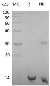Human SULT1C4/SULT1C2/hCG_27301 recombinant protein
