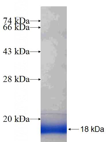 Recombinant Human RBX1 SDS-PAGE