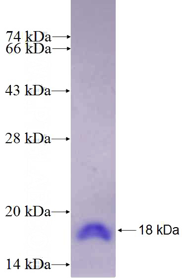 Recombinant Human CD302 SDS-PAGE