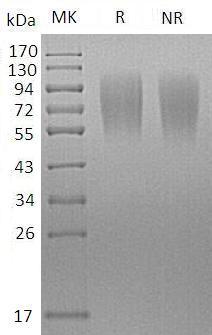 Mouse Lamp1/Lamp-1 (His tag) recombinant protein
