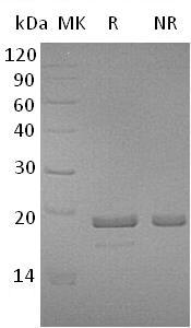 Human MDP1 (His tag) recombinant protein