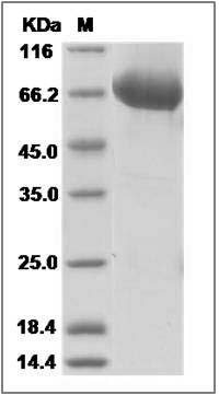 Rat B7-DC / PD-L2 / CD273 Protein (Fc Tag) SDS-PAGE